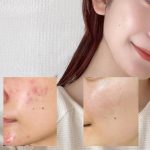 آمپول آنوا تسکین دهنده و مرطوب کننده آنوا Anua حجم 30میلی لیتر